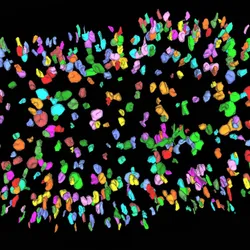 A mouse kidney at birth with the filtering units (nephrons) labelled in different colors by an AI software. A mouse kidney at birth with the filtering units (nephrons) labelled in different colors by an AI software.