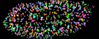 A mouse kidney at birth with the filtering units (nephrons) labelled in different colors by an AI software.