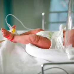 Image of a preterm baby in the neonatal section of the maternity ward. Image of a preterm baby in the neonatal section of the maternity ward.