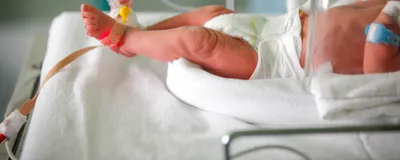 Image of a preterm baby in the neonatal section of the maternity ward. 