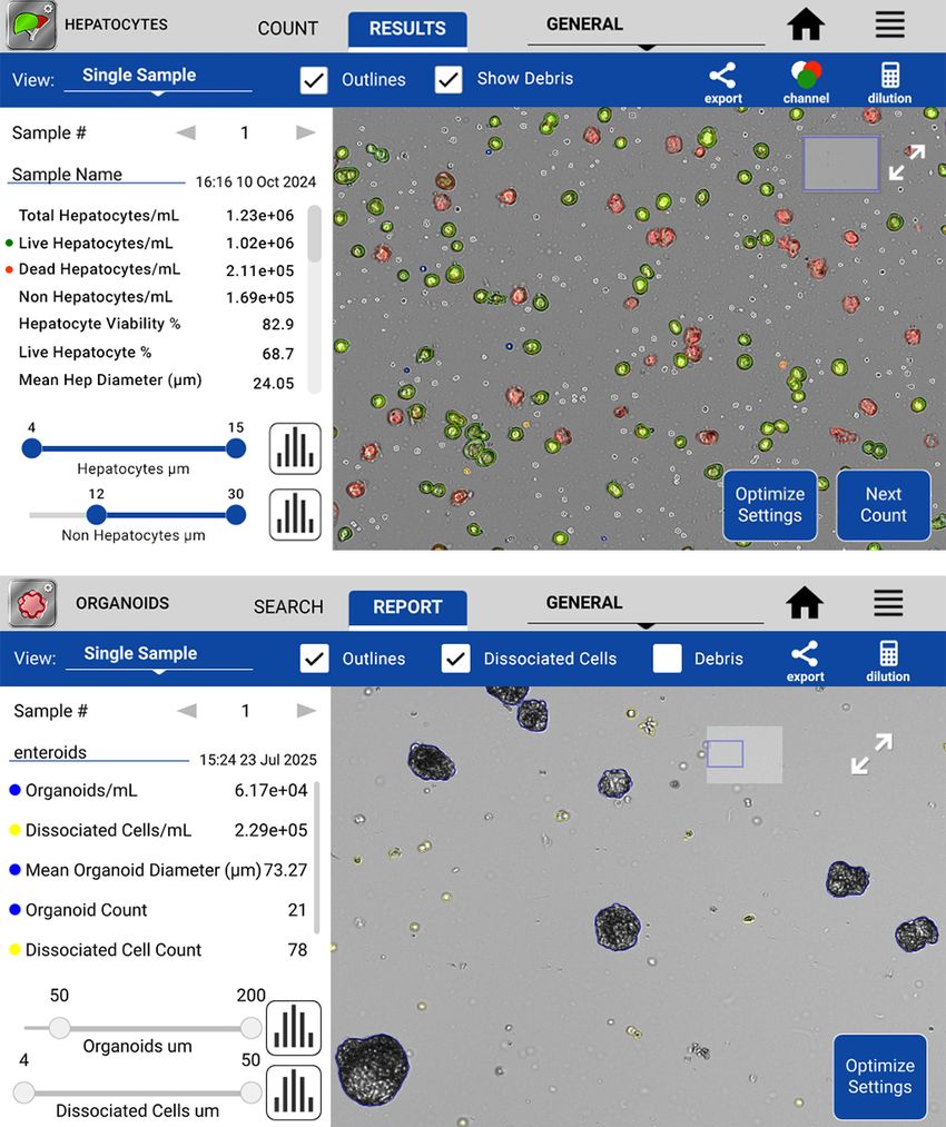Screenshots showing the platform’s results after analyzing a hepatocyte sample (top) and an organoid sample (bottom).