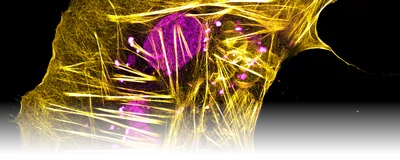 Image of a boa constrictor brain-derived cell. Its actin cytoskeleton is stained yellow, and the cellular DNA is stained in pink. 