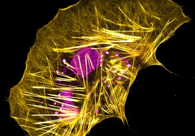 Image of a boa constrictor brain-derived cell. Its actin cytoskeleton is stained yellow, and the cellular DNA is stained in pink. 