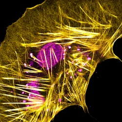 Image of a boa constrictor brain-derived cell. Its actin cytoskeleton is stained yellow, and the cellular DNA is stained in pink. Image of a boa constrictor brain-derived cell. Its actin cytoskeleton is stained yellow, and the cellular DNA is stained in pink.