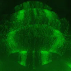 Fluorescent image of a mouse cerebellum with Purkinje cells expressing green fluorescent protein. Where cells have died, there are gaps organized into stripes across the tissue. 
