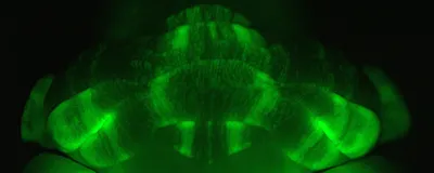 Fluorescent image of a mouse cerebellum with Purkinje cells expressing green fluorescent protein. Where cells have died, there are gaps organized into stripes across the tissue. 