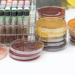 Photograph of bacterial cultures grown in test tubes and petri dishes on a laboratory bench Photograph of bacterial cultures grown in test tubes and petri dishes on a laboratory bench
