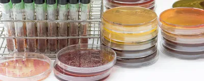 Photograph of bacterial cultures grown in test tubes and petri dishes on a laboratory bench
