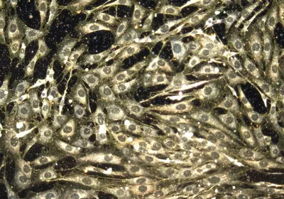 Microscopy image of an array of cells is shown against a black background. Yellow dots, which are the nanoparticles delivering cancer drugs to the body, are at the intersections between the cells.