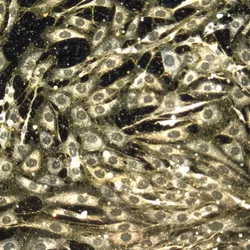 Microscopy image of an array of cells is shown against a black background. Yellow dots, which are the nanoparticles delivering cancer drugs to the body, are at the intersections between the cells.