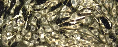 Microscopy image of an array of cells is shown against a black background. Yellow dots, which are the nanoparticles delivering cancer drugs to the body, are at the intersections between the cells. Microscopy image of an array of cells is shown against a black background. Yellow dots, which are the nanoparticles delivering cancer drugs to the body, are at the intersections between the cells.