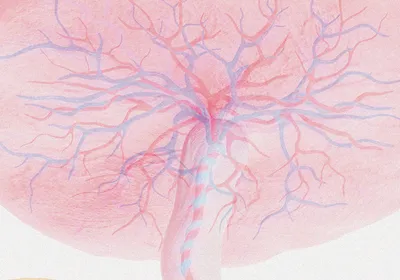 Illustration shows a human placenta with branching blood vessels. Illustration shows a human placenta with branching blood vessels.