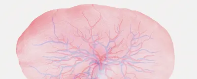 Illustration shows a human placenta with branching blood vessels.