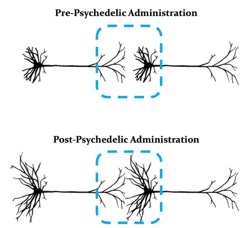 Illustration shows how dendrites at the end of neurons grow following the administration of a psychedelic.