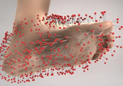 3D illustration of a foot covered in pins with round red balls on the end. This depicts the sensation of pins and needles that is created when a limb is cut off from oxygen and then the nerves overreact. 
