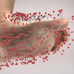 3D illustration of a foot covered in pins with round red balls on the end. This depicts the sensation of pins and needles that is created when a limb is cut off from oxygen and then the nerves overreact. 