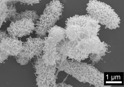 Black-and-white microscopy image of bacteria individually wrapped in nanonets formed by the self-weaving antimicrobial peptides. 