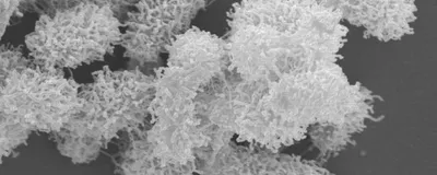 Black-and-white microscopy image of bacteria individually wrapped in nanonets formed by the self-weaving antimicrobial peptides. 