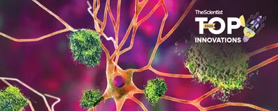 An illustration of green amyloid plaques surrounding a coral neuron in brain tissue.