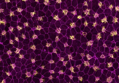 Microscopy image of a fully developed frog embryo skin tissue, which researchers recently filmed live to gain a complete picture of the developmental process. From the images they took during this process, they quantified changes in cell shape and movement as well as how these changes contribute to the cells’ final fate. Microscopy image of a fully developed frog embryo skin tissue, which researchers recently filmed live to gain a complete picture of the developmental process. From the images they took during this process, they quantified changes in cell shape and movement as well as how these changes contribute to the cells’ final fate.