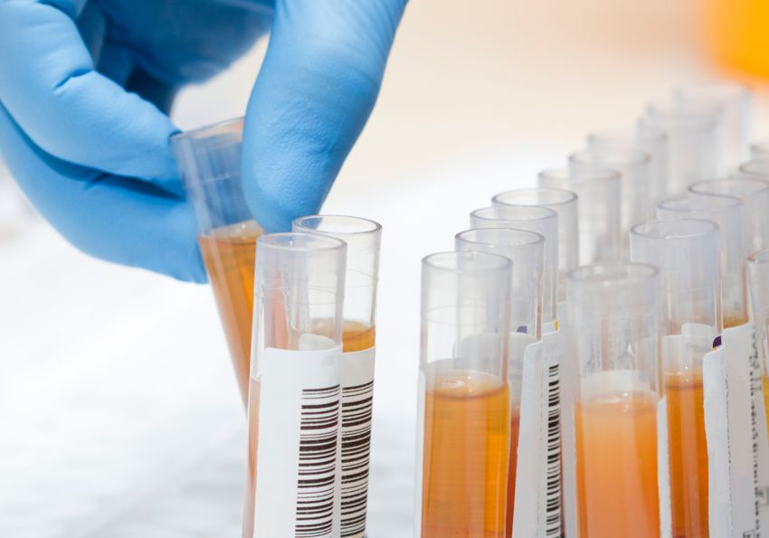A hand wearing a blue glove holds one of many test tubes containing blood samples with the plasma separated from the cells