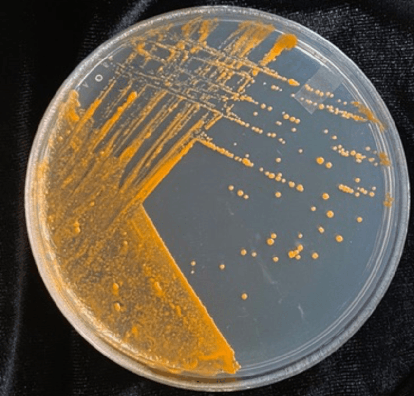 A petri dish with Gordonia alkanivorans (bright orange colonies) growing on guaiacol-supplemented medium. A petri dish with Gordonia alkanivorans (bright orange colonies) growing on guaiacol-supplemented medium.