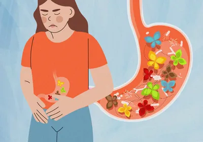 Image of a woman with her hands across her stomach. She has a look of discomfort on her face. There is a blown up image of her stomach next to her and it has colorful butterflies and gut bacteria all swarming within the gut.