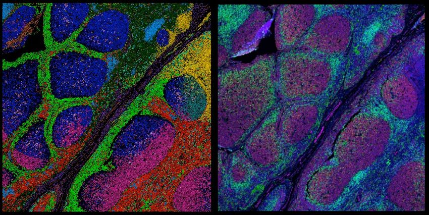 Two-panel (left and right), multi-colored protein imaging data of a human lymph node tissue section.