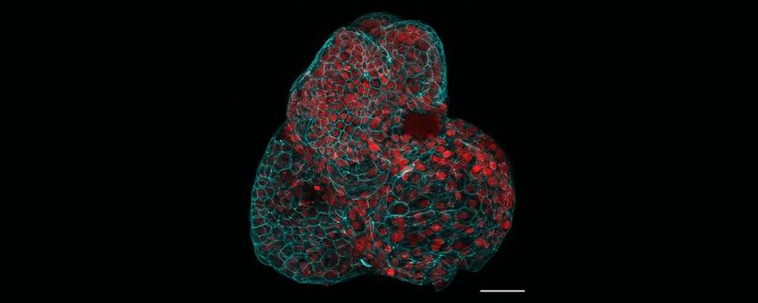 Red cells encased in cyan webbing