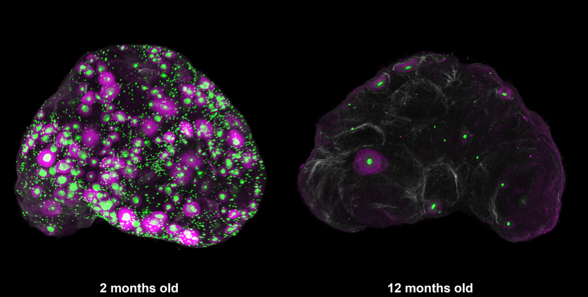 An age-dependent decline in the number of eggs (green) and the subset of growing eggs (magenta) in an intact mouse ovary, shown across a time scale equivalent of age 18 to 40 in human years. An age-dependent decline in the number of eggs (green) and the subset of growing eggs (magenta) in an intact mouse ovary, shown across a time scale equivalent of age 18 to 40 in human years.