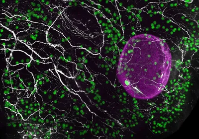 A network of sympathetic nerves (white) innervating and growing alongside the eggs (green) within a fragment of a human ovary. A large growing follicle containing an egg is shown in magenta. A network of sympathetic nerves (white) innervating and growing alongside the eggs (green) within a fragment of a human ovary. A large growing follicle containing an egg is shown in magenta.