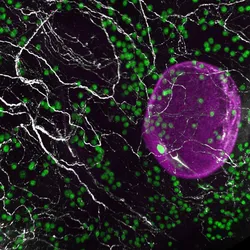 A network of sympathetic nerves (white) innervating and growing alongside the eggs (green) within a fragment of a human ovary. A large growing follicle containing an egg is shown in magenta. A network of sympathetic nerves (white) innervating and growing alongside the eggs (green) within a fragment of a human ovary. A large growing follicle containing an egg is shown in magenta.