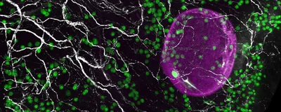 A network of sympathetic nerves (white) innervating and growing alongside the eggs (green) within a fragment of a human ovary. A large growing follicle containing an egg is shown in magenta. A network of sympathetic nerves (white) innervating and growing alongside the eggs (green) within a fragment of a human ovary. A large growing follicle containing an egg is shown in magenta.