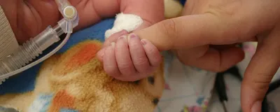 A premature infant in the NICU. Premature babies that heard their mother’s voice regularly showed better brain development than infants who did not.
