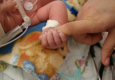 A premature infant in the NICU. Premature babies that heard their mother’s voice regularly showed better brain development than infants who did not. A premature infant in the NICU. Premature babies that heard their mother’s voice regularly showed better brain development than infants who did not.