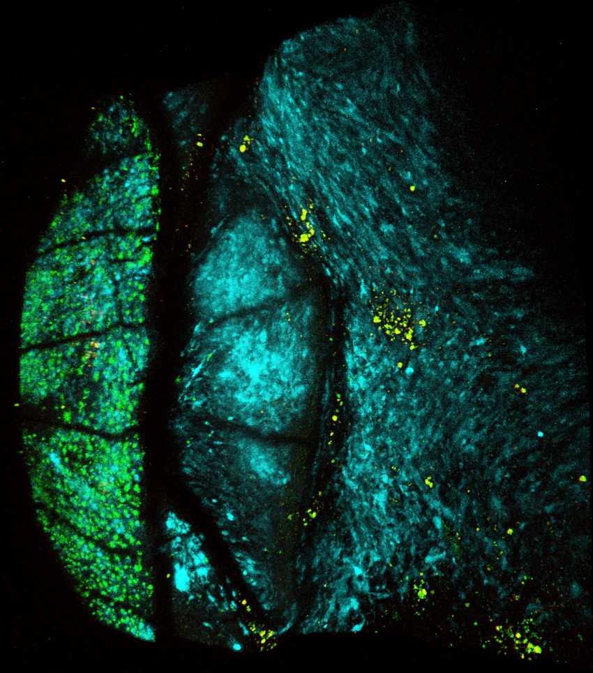 Blue- and green-colored dots against a black background depicting a melanoma tumor with CRATERs on its surface, where T cells localize. Blue- and green-colored dots against a black background depicting a melanoma tumor with CRATERs on its surface, where T cells localize.