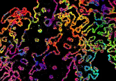 Abstract multicolored image representing a cross section of tissue and the spatial organization of cells. Abstract multicolored image representing a cross section of tissue and the spatial organization of cells.