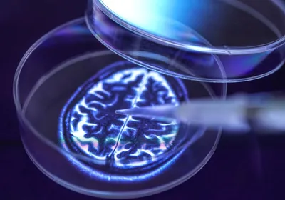 A pipette dispenses liquid into a petri dish displaying an image of a human brain, symbolizing neural organoid research A pipette dispenses liquid into a petri dish displaying an image of a human brain, symbolizing neural organoid research