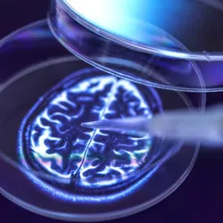 A pipette dispenses liquid into a petri dish displaying an image of a human brain, symbolizing neural organoid research