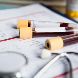 Three sealed glass vials containing blood samples lying on top of a clipboard. Three sealed glass vials containing blood samples lying on top of a clipboard.