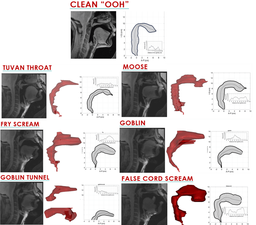 Visualization of the structure of the vocal tracts of a metal singer as they produce either a typical “ooh” sound (top) or six different extreme vocal screams. The clean image shows a static MRI and illustration and spectrogram of the arrow and distance from the glottis. Each of the extreme vocal phonations shows this along with a 3D reconstruction of the vocal tract space to help see the various constriction and expansion that occurs to produce the screams. Visualization of the structure of the vocal tracts of a metal singer as they produce either a typical “ooh” sound (top) or six different extreme vocal screams. The clean image shows a static MRI and illustration and spectrogram of the arrow and distance from the glottis. Each of the extreme vocal phonations shows this along with a 3D reconstruction of the vocal tract space to help see the various constriction and expansion that occurs to produce the screams.