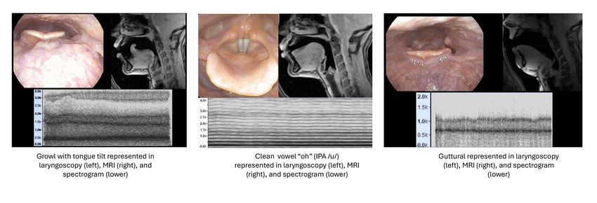 Three sets of data, representing a “Growl” vocalization (left), “clean” phonation (center), and “Guttural” type of scream (right). Each sound type includes a laryngoscopy (left), static MRI (right), and spectrogram (bottom). In the growl and guttural vocalization, the larynx is obstructed from view by the epiglottis Three sets of data, representing a “Growl” vocalization (left), “clean” phonation (center), and “Guttural” type of scream (right). Each sound type includes a laryngoscopy (left), static MRI (right), and spectrogram (bottom). In the growl and guttural vocalization, the larynx is obstructed from view by the epiglottis