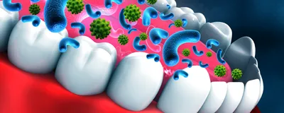 3D illustration of a human mouth with oversized blue, comma-shaped bacteria and green, spiked viruses overlayed on the tongue and teeth. This represents the oral microbiome. 3D illustration of a human mouth with oversized blue, comma-shaped bacteria and green, spiked viruses overlayed on the tongue and teeth. This represents the oral microbiome.