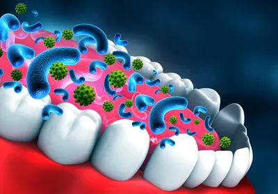 3D illustration of a human mouth with oversized blue, comma-shaped bacteria and green, spiked viruses overlayed on the tongue and teeth. This is representing the oral microbiome.