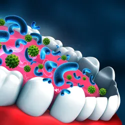 3D illustration of a human mouth with oversized blue, comma-shaped bacteria and green, spiked viruses overlayed on the tongue and teeth. This is representing the oral microbiome.