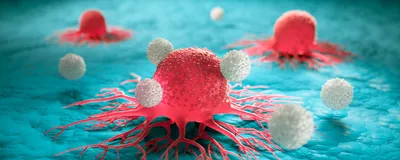 Image of pink cancer cells attacked by white blood cells.