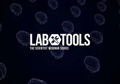 Exploring Organoids for Neurological Disease Modeling Exploring Organoids for Neurological Disease Modeling