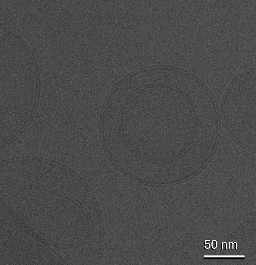 Several spherical extracellular vesicles, which appear grey on a grey background. Several spherical extracellular vesicles, which appear grey on a grey background.