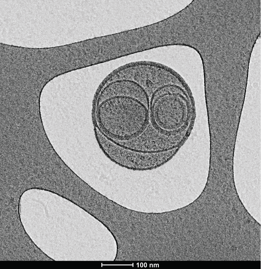 Extracellular vesicles appear like a grey smiley face on a pale background. Extracellular vesicles appear like a grey smiley face on a pale background.