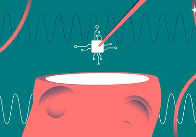 Vector illustration of implanting of brain chips into human head. 